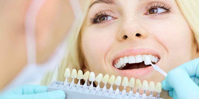 Cosmetic Dentist The Smile Youve Always Dreamed Of 768x384