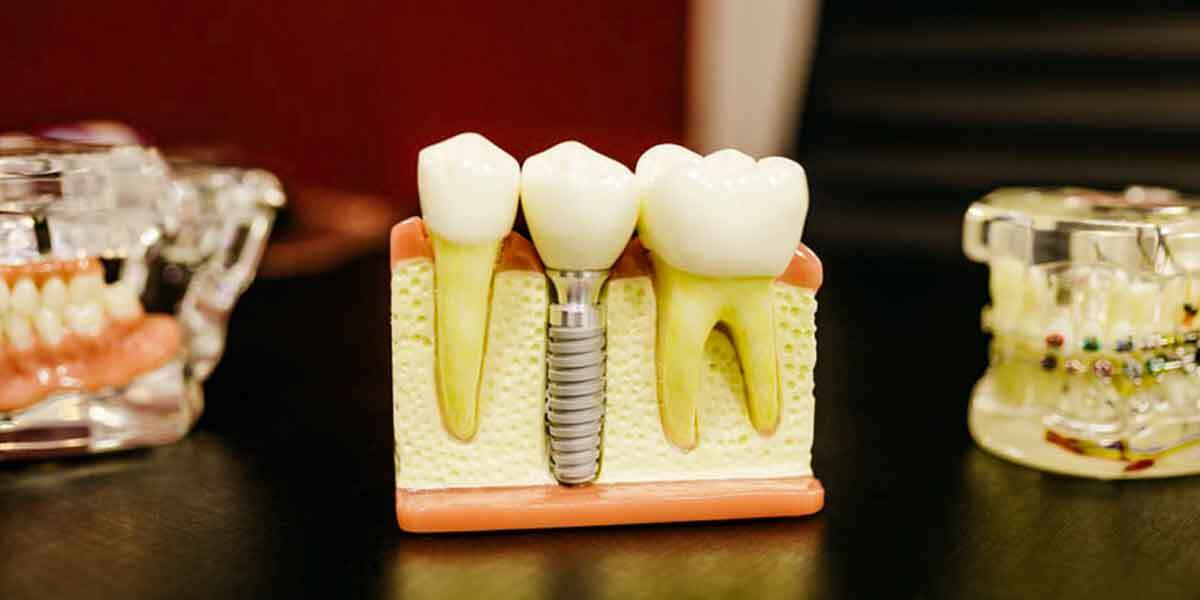 Tips to Keep in Mind Before Preparing For a Dental Appointment Near Me