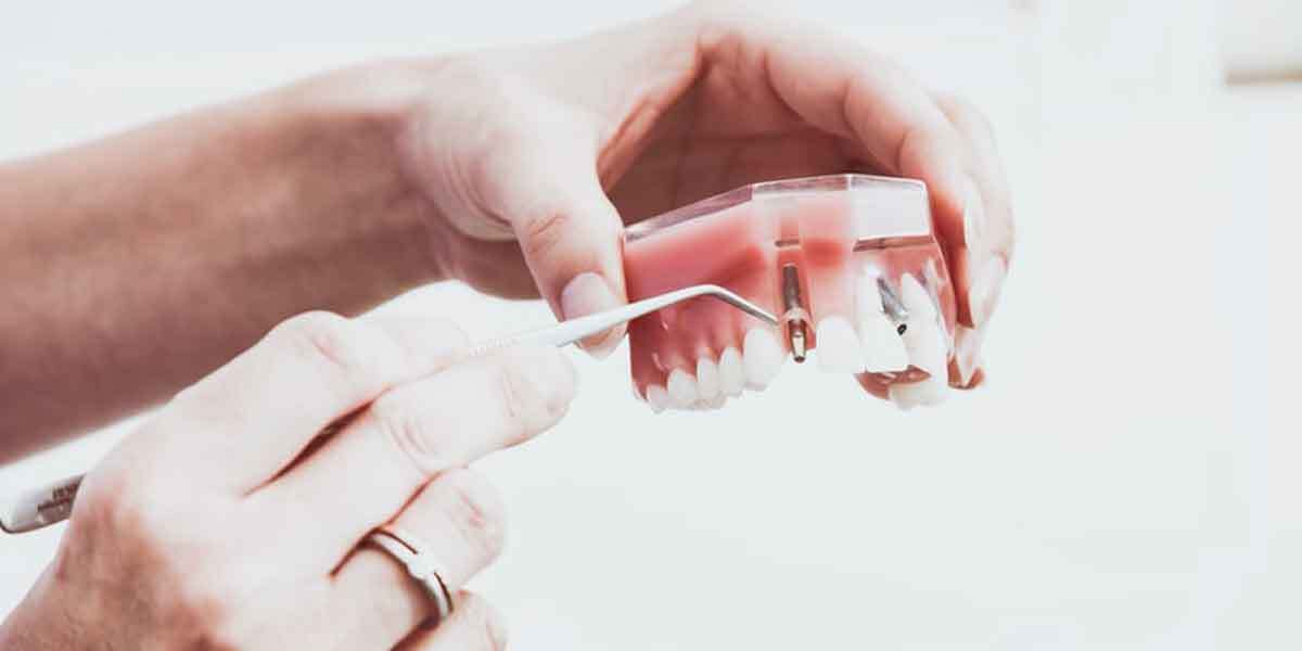 Benefits Of Dental Imaging That Has Revolutionized The Dentistry World