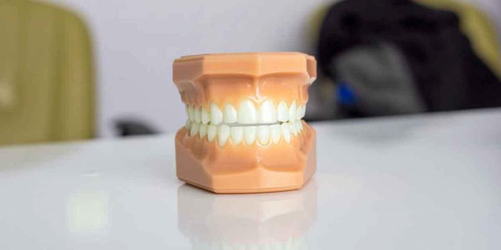 Full Mouth Restoration Procedure: Important Decisions to Consider