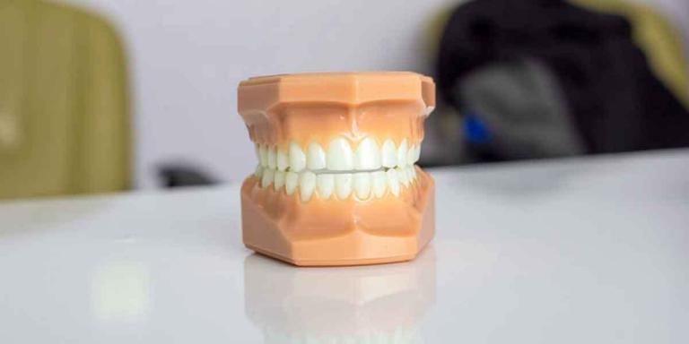 Full Mouth Restoration Procedure: Important Decisions to Consider