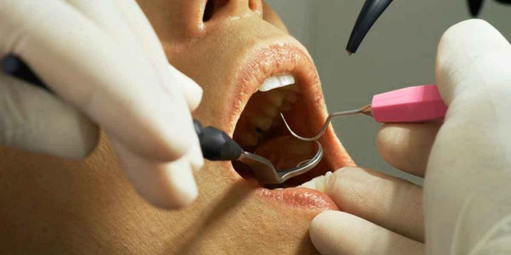 Understanding Pediatric Tooth Decay in Details