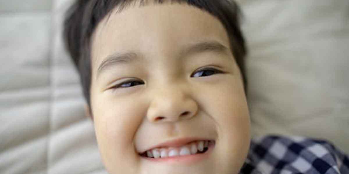 What Causes Pediatric Tooth Decay? A Comprehensive Guide