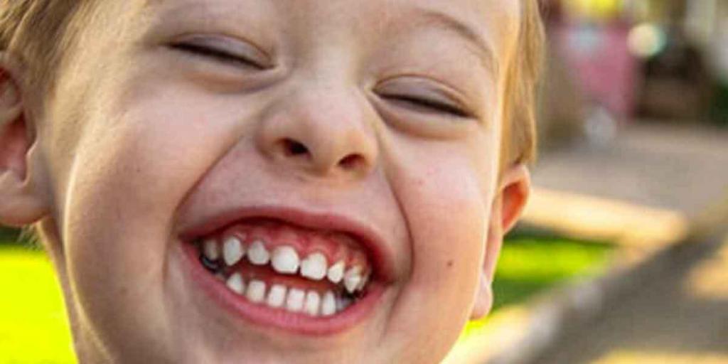 Why Baby Teeth Care Is Important To Know For All Parents?