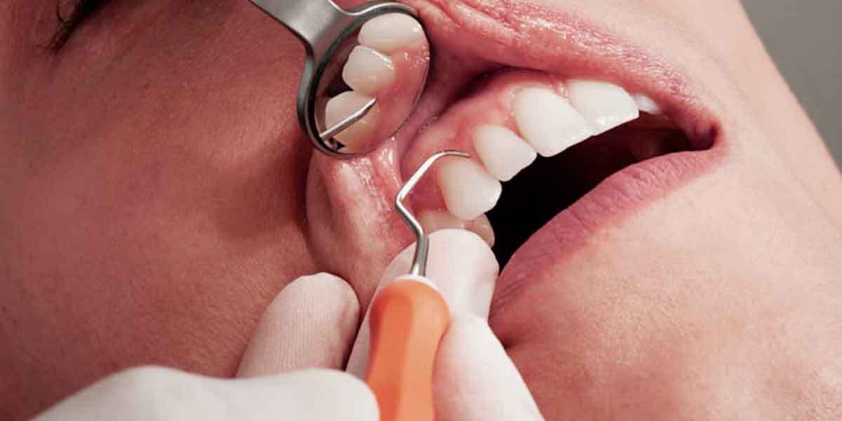 Dental Care Tips if You Don't Find a Dentist That Accept Medicaid Near Me