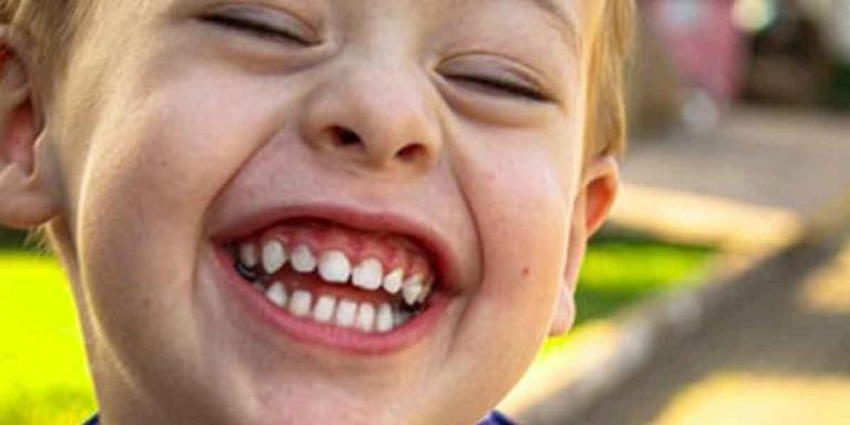 Finding the Best Pediatric Dentist Near Me