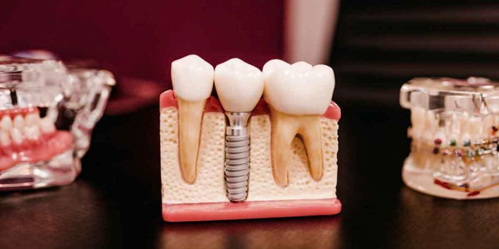 How to Find a Cheap Dentist Near Me