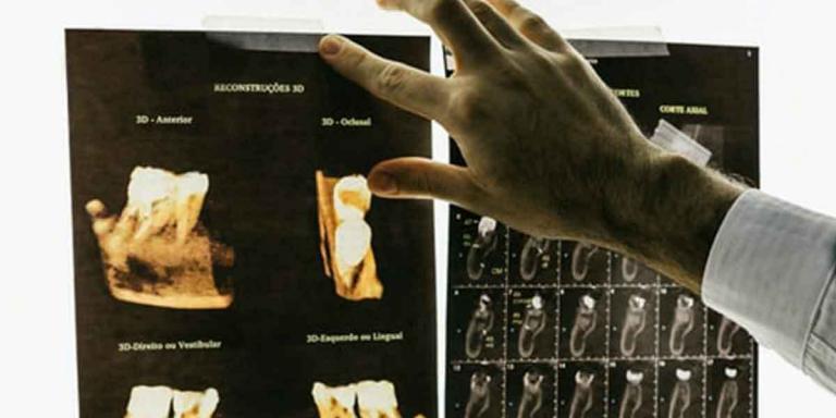 How to Find the Right Family Dentist Near Me