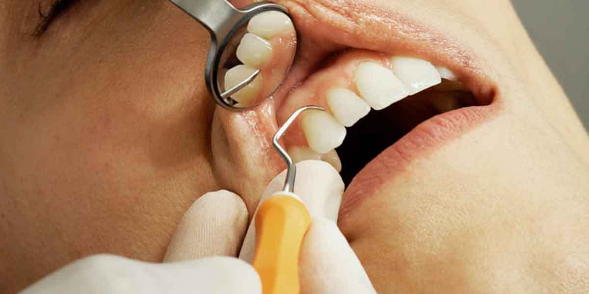 What to Do Before Visiting a Dentist Oral Surgeon Near Me