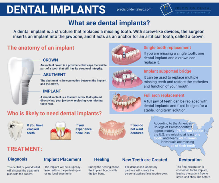Dental Implants jpg 768x643