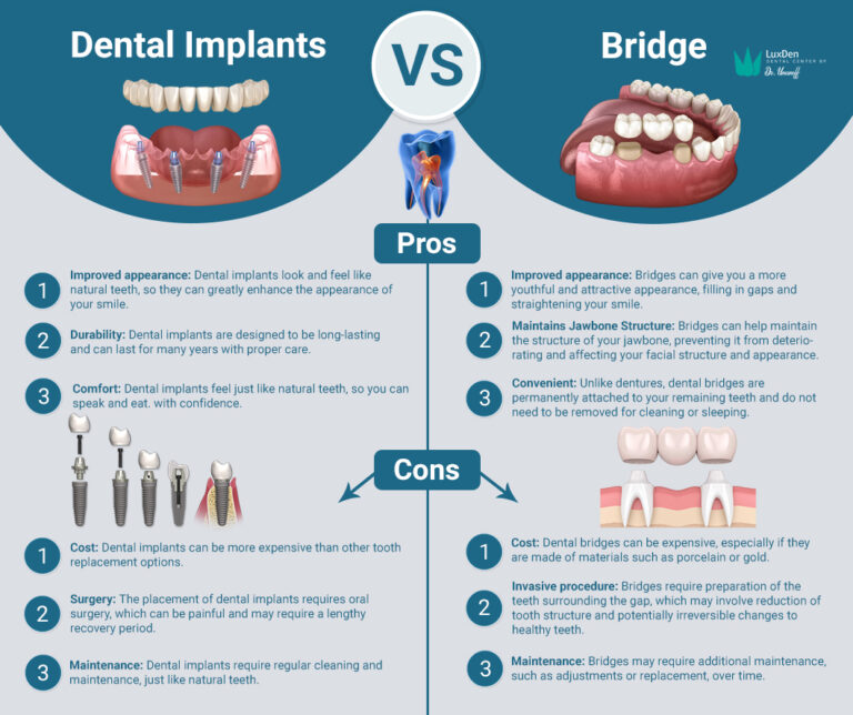 Dental implants vs dental bridge 768x644