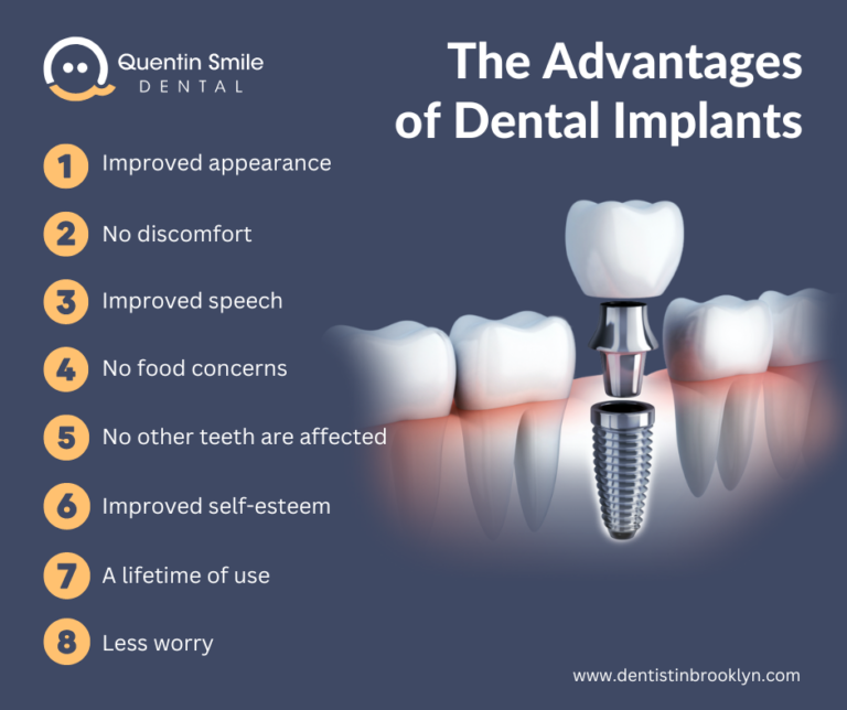 The Advantages of Dental Implants 768x644