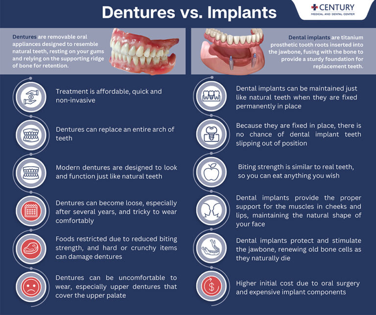 dentures vs implants 768x644