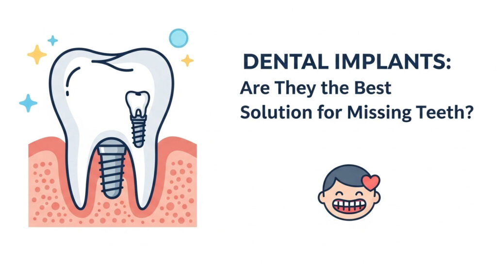 Dental Implants: Are They the Best Solution for Missing Teeth