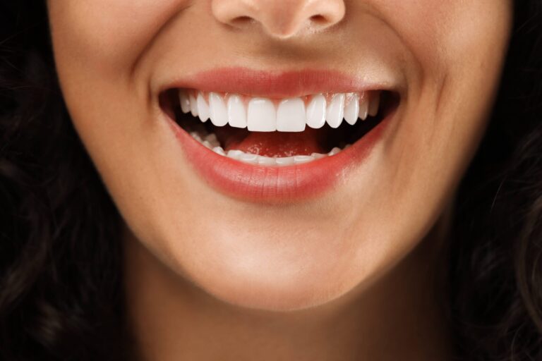 Ventura Bright Dental Happy Smile 768x512