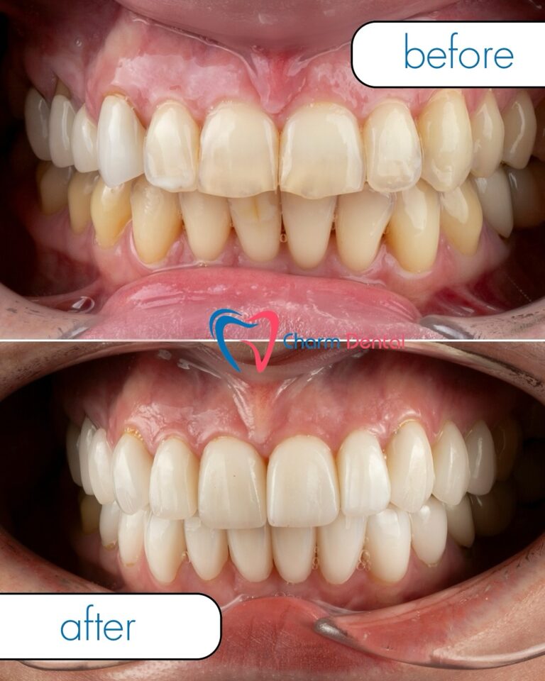 Dentist in Humble TX