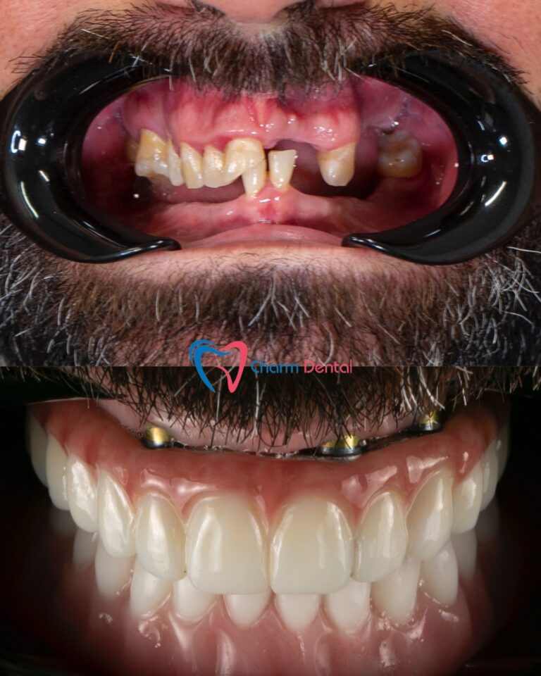 Best Dentist in Katy 768x960