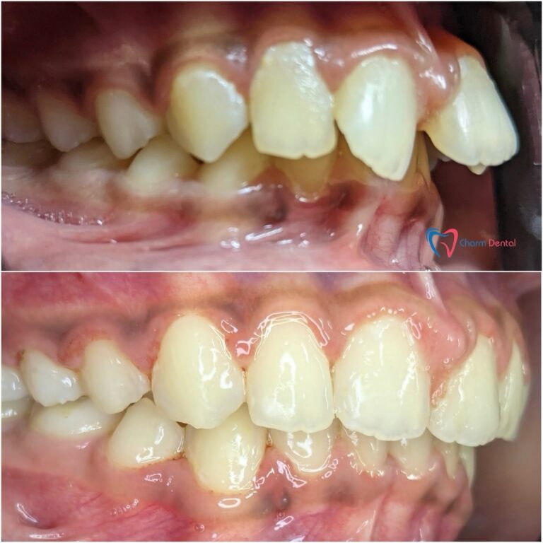 dentist in spring tx 77373 768x768