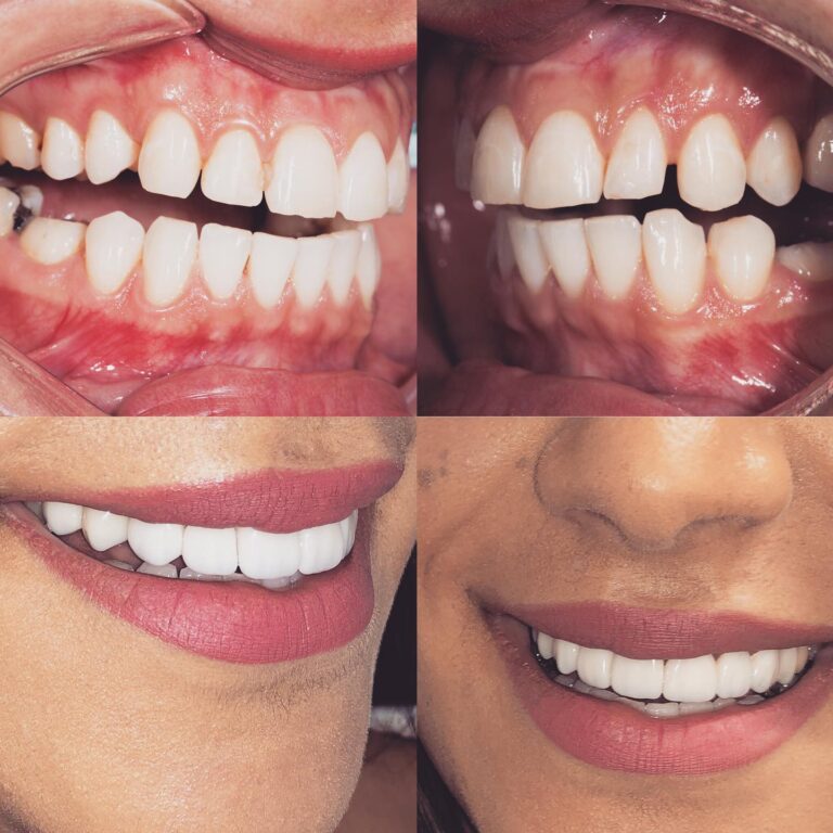 smile makeover 768x768