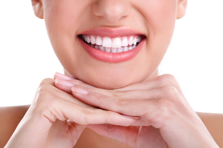 Teeth Whitening 768x512